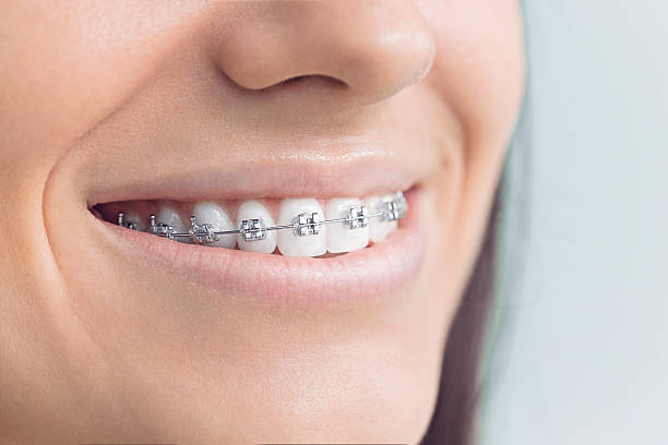 Best Invisalign and Clear Aligners  in Attica, MI